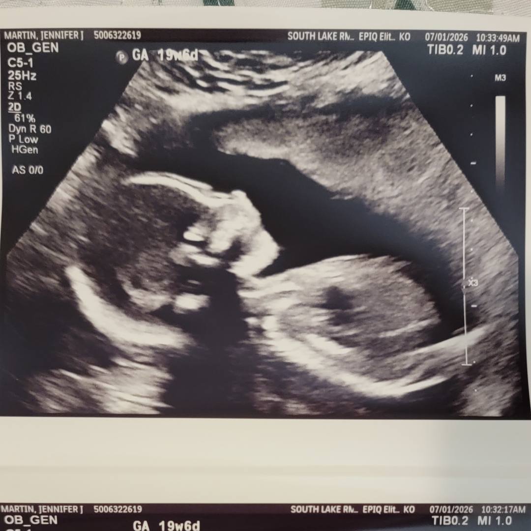 Photo shared by Jennifer for their Babylist baby registry.