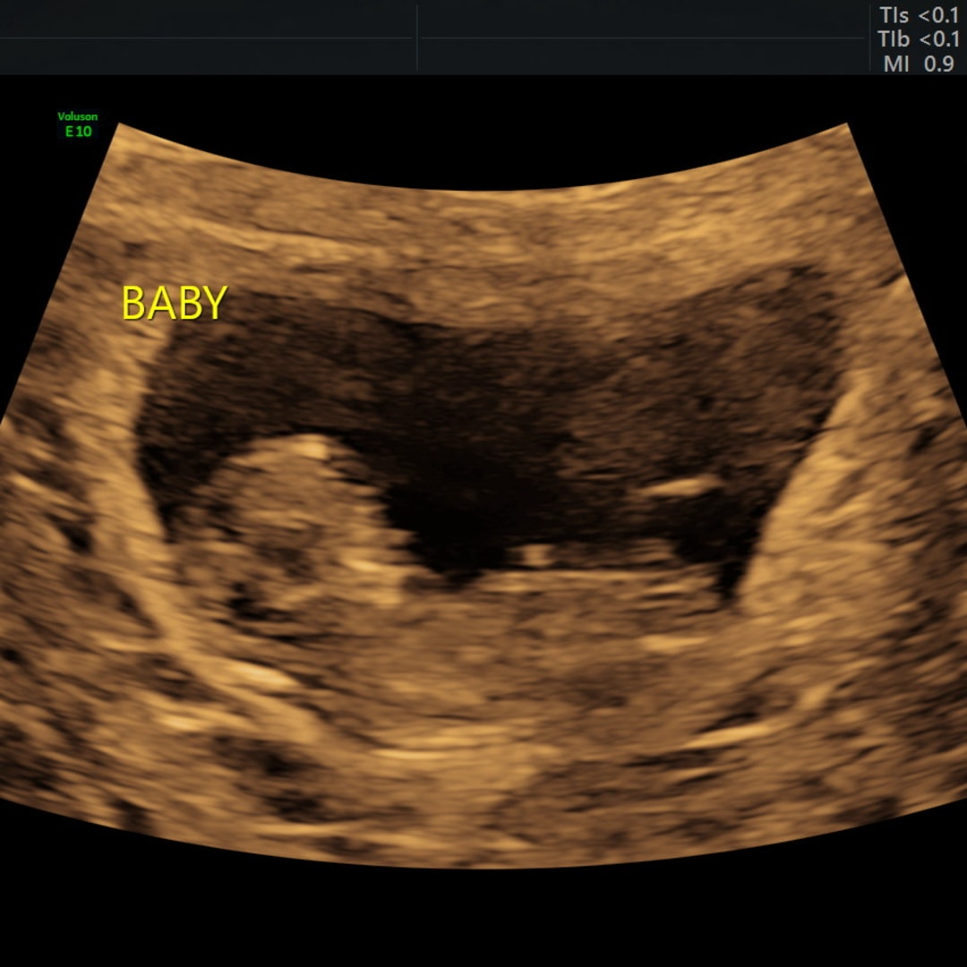 Photo shared by Alexis for their Babylist baby registry.