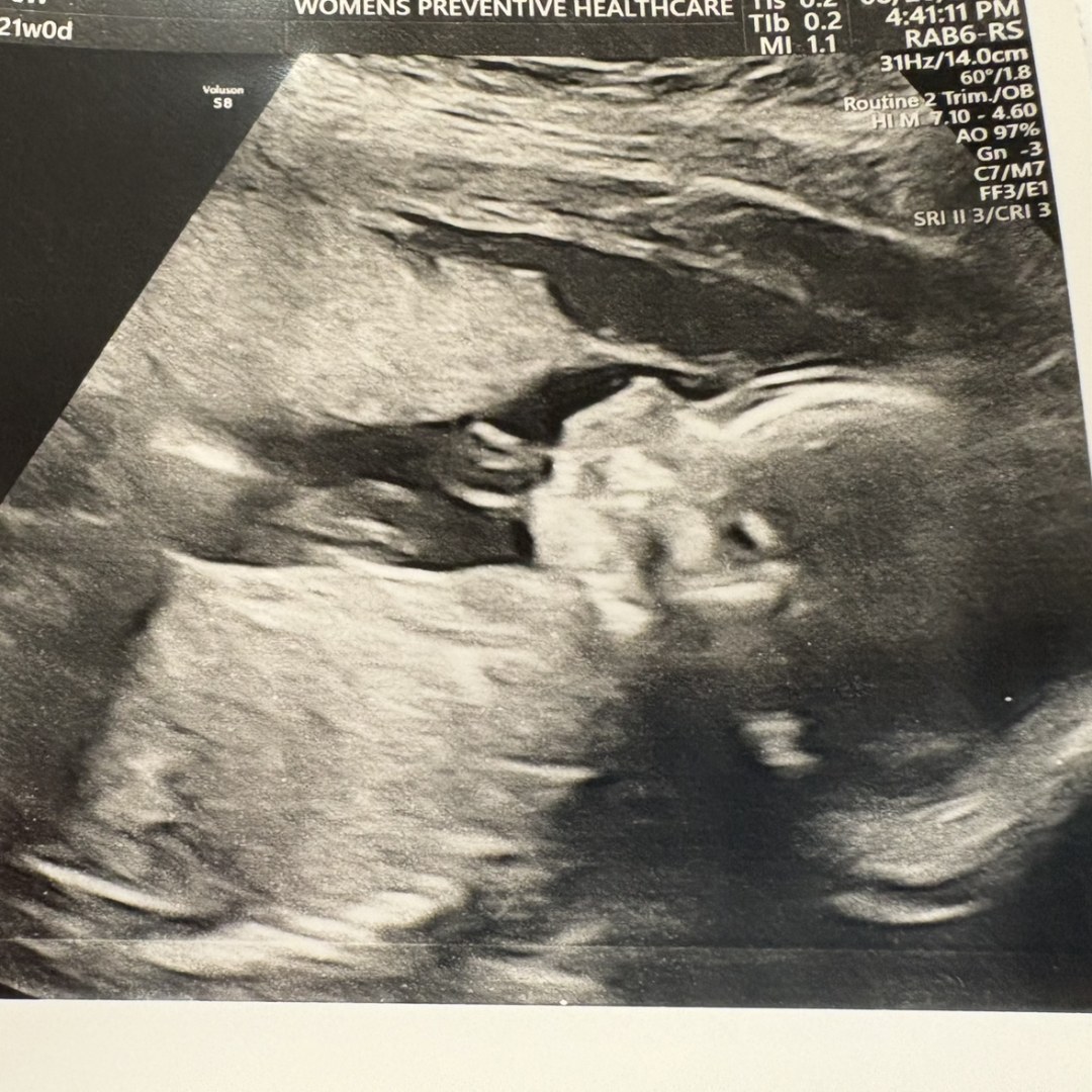 Photo shared by Faith for their Babylist baby registry.