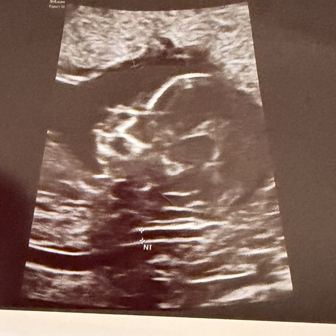 Photo shared by Cheyenne for their Babylist baby registry.