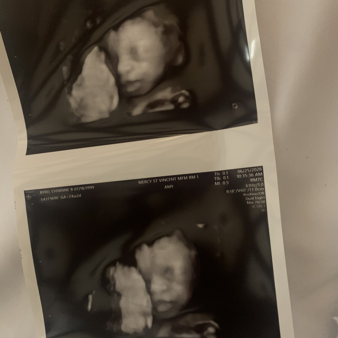 Photo shared by Chyanne for their Babylist baby registry.