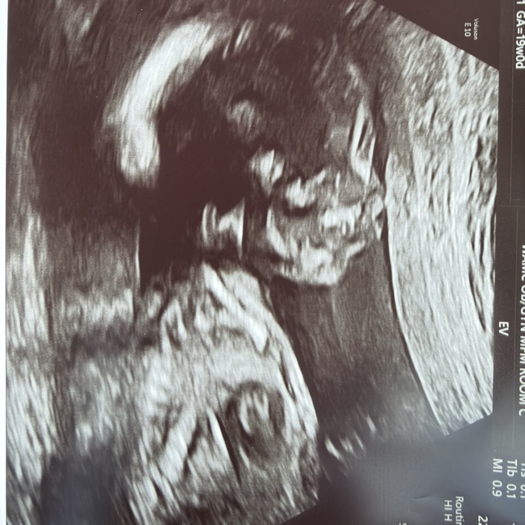 Photo shared by Ashlee for their Babylist baby registry.