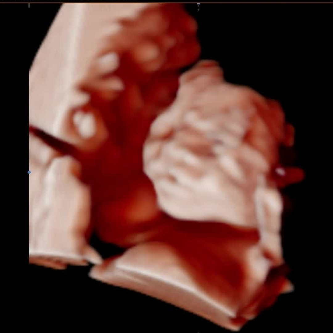 Photo shared by Hazel for their Babylist baby registry.