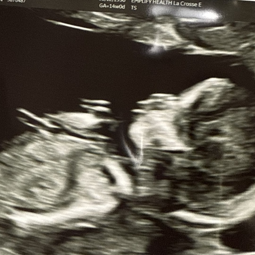 Photo shared by Melissa for their Babylist baby registry.