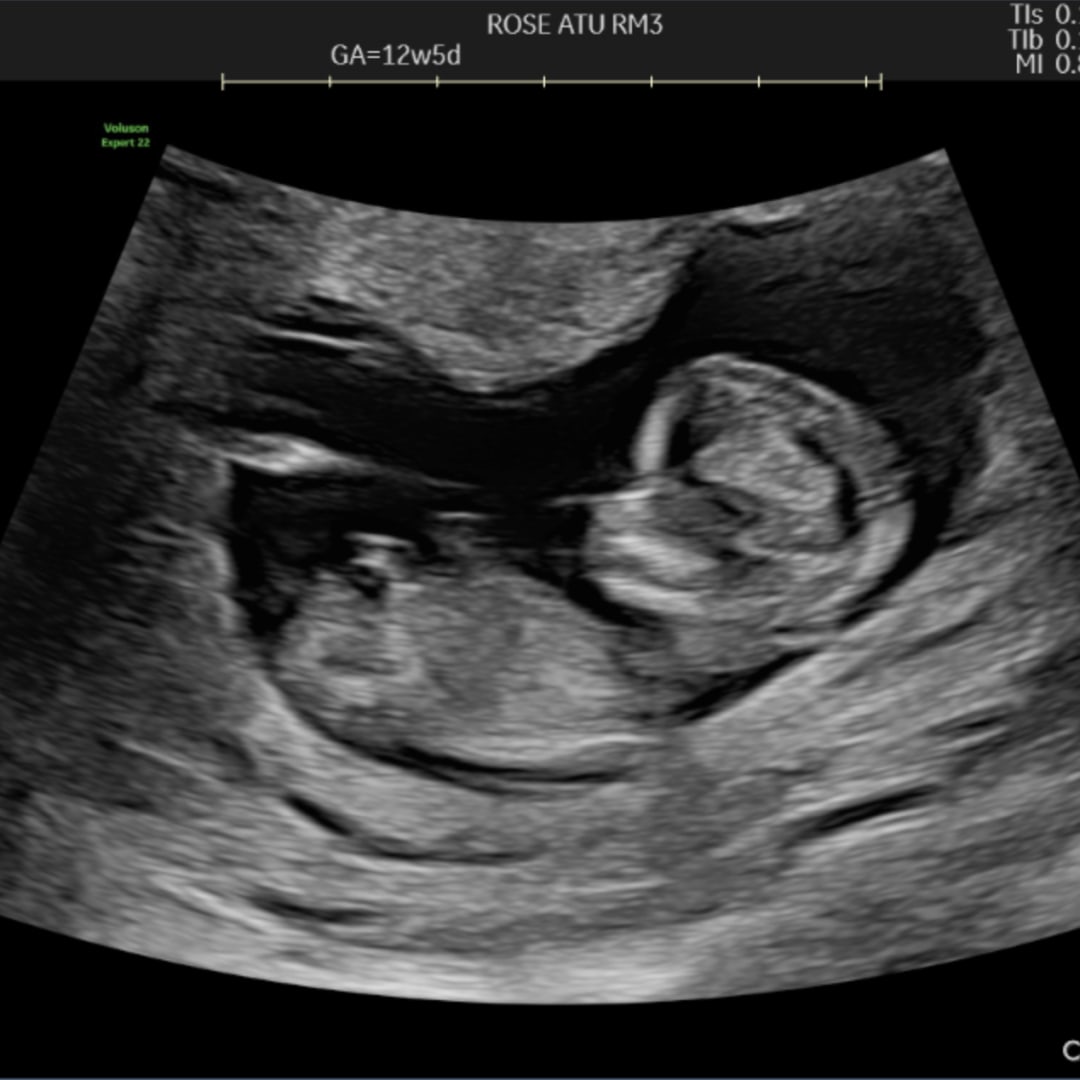 Photo shared by Gillian for their Babylist baby registry.