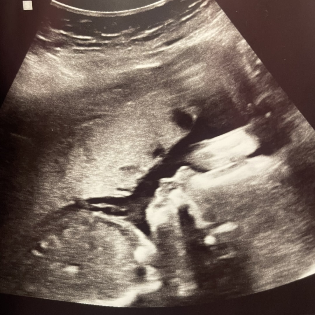 Photo shared by Anna for their Babylist baby registry.