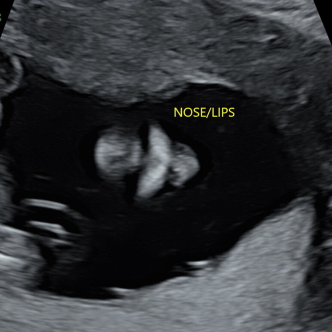 Photo shared by Ameyah for their Babylist baby registry.