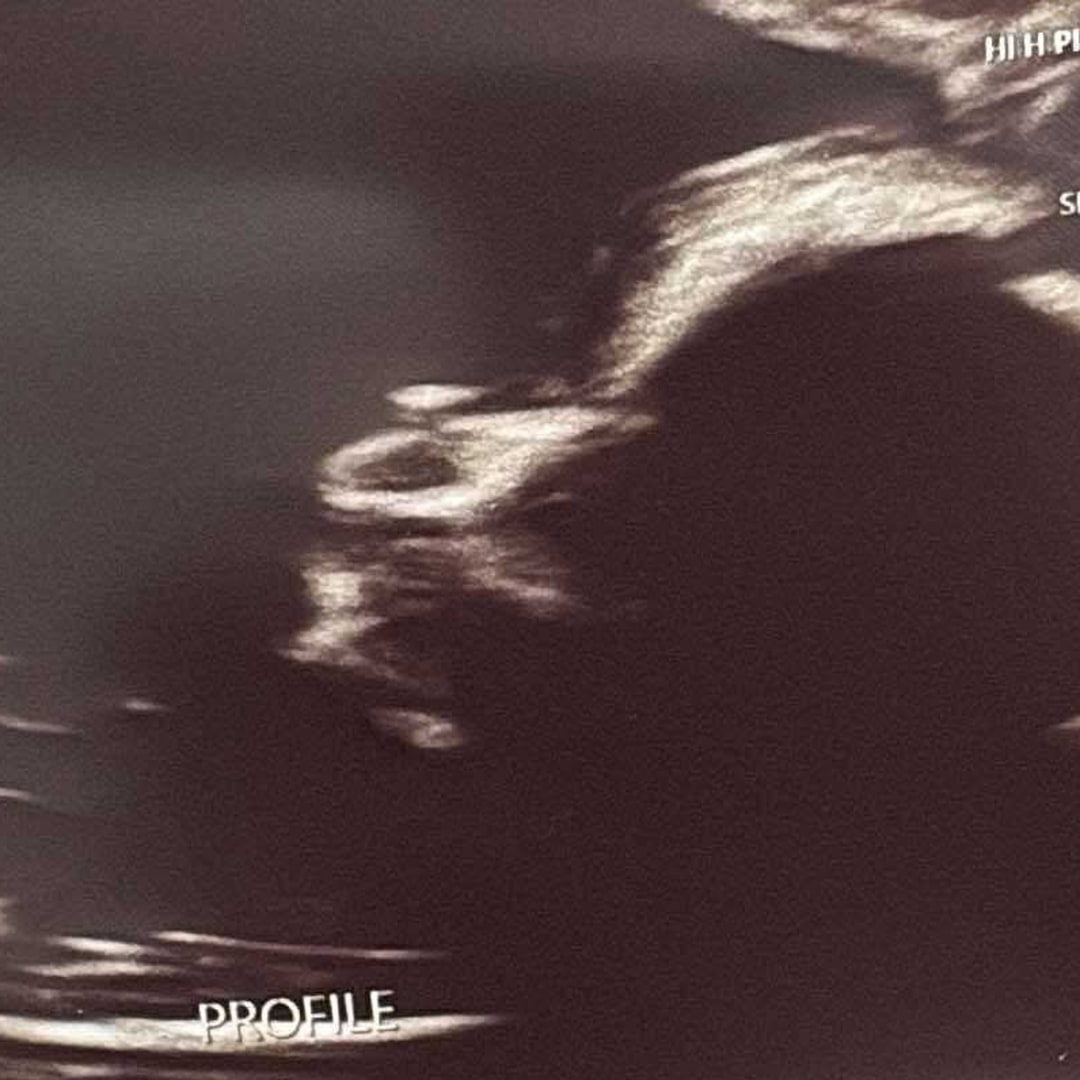Photo shared by Olivia for their Babylist baby registry.