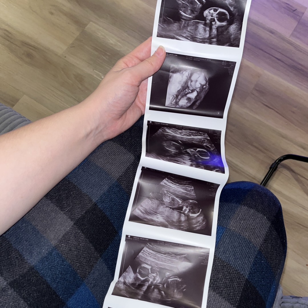 Photo shared by Shelby for their Babylist baby registry.