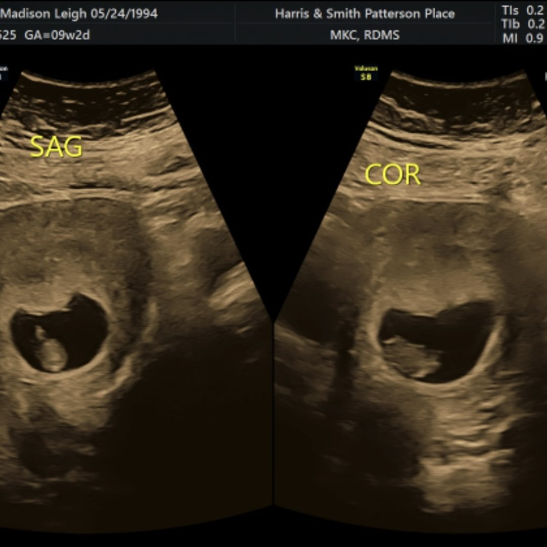 Photo shared by Madison for their Babylist baby registry.