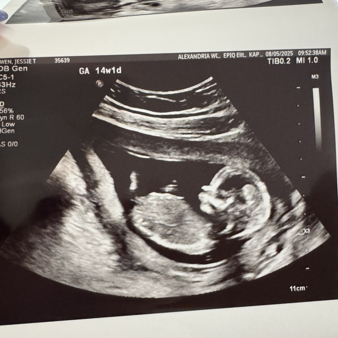 Photo shared by Jessie for their Babylist baby registry.