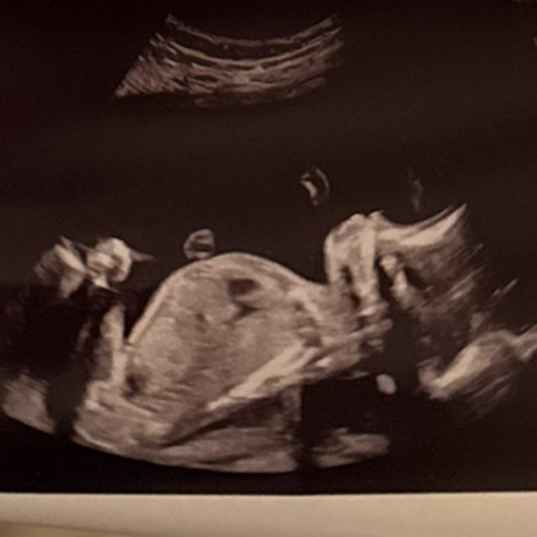 Photo shared by Stephanie for their Babylist baby registry.