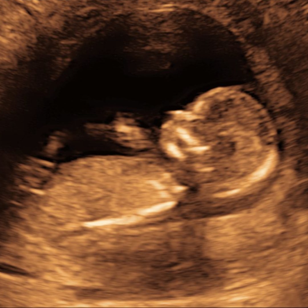 Photo shared by Brittany for their Babylist baby registry.