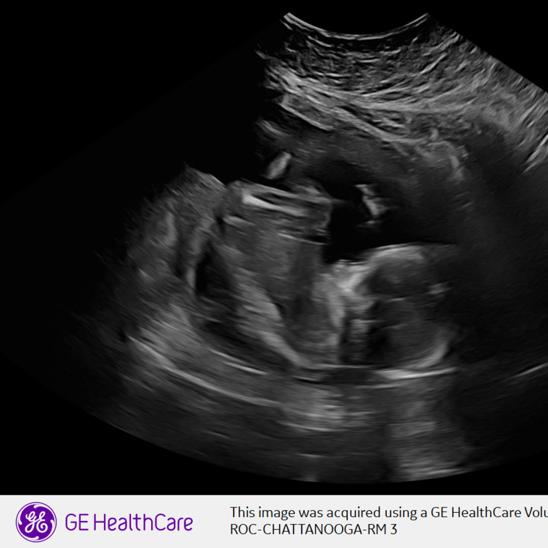 Photo shared by Rachel for their Babylist baby registry.