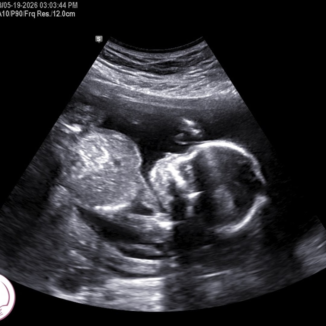 Photo shared by Hayley for their Babylist baby registry.