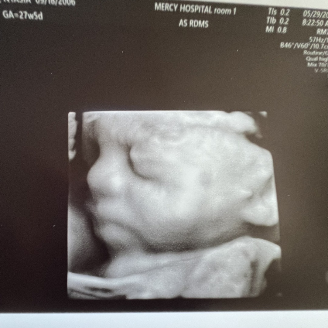 Photo shared by Nyasia for their Babylist baby registry.