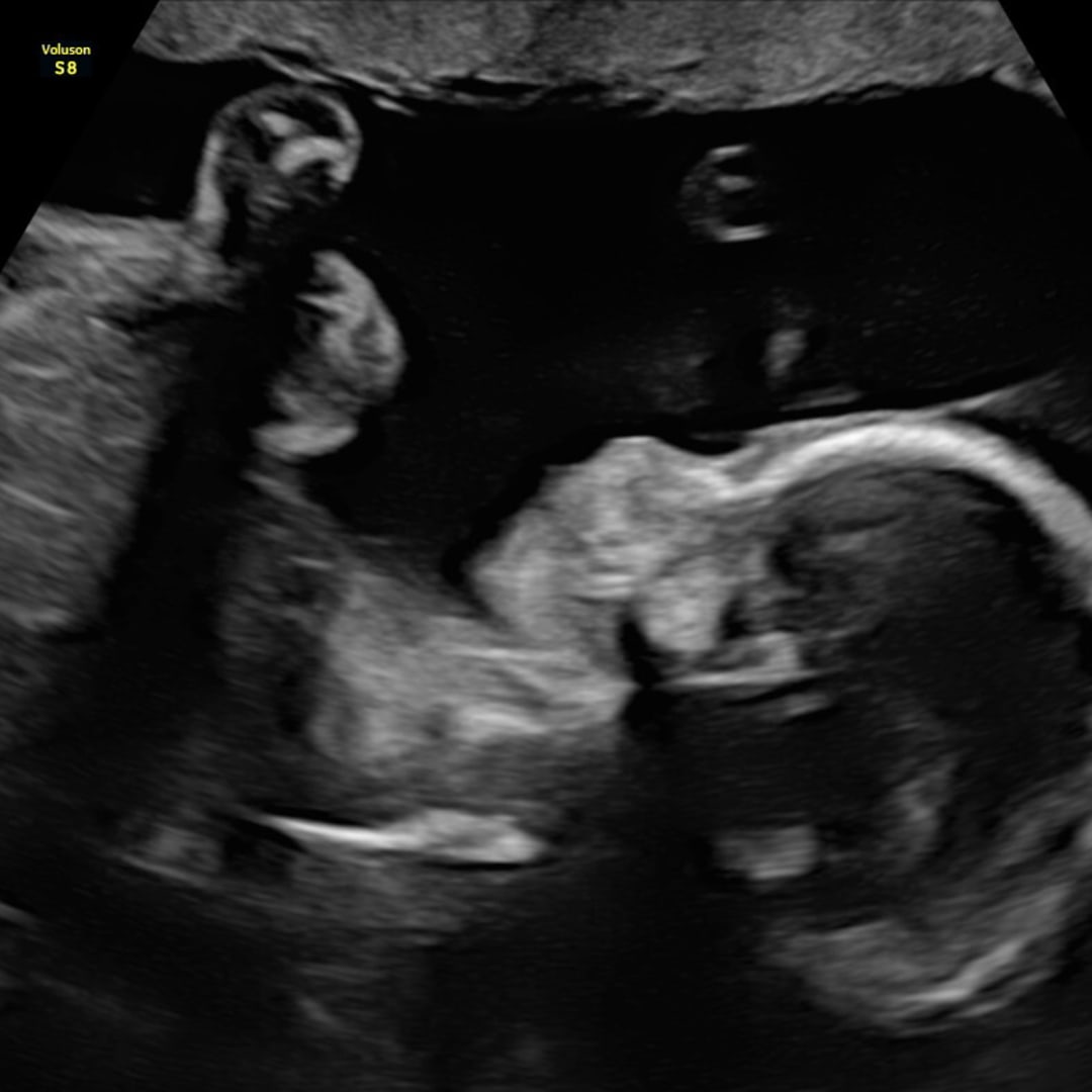 Photo shared by Erin for their Babylist baby registry.