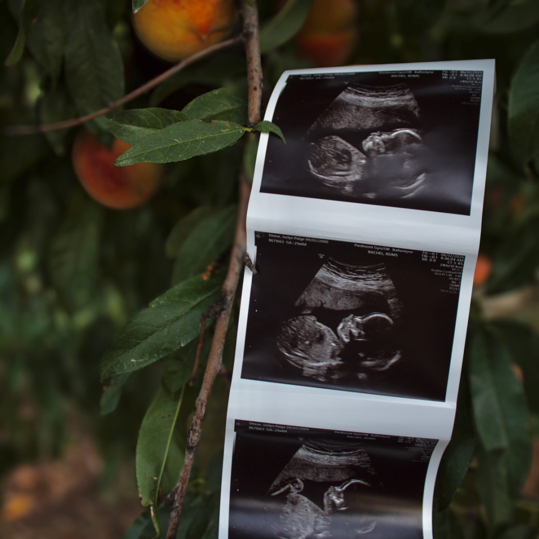 Photo shared by Jazlyn for their Babylist baby registry.