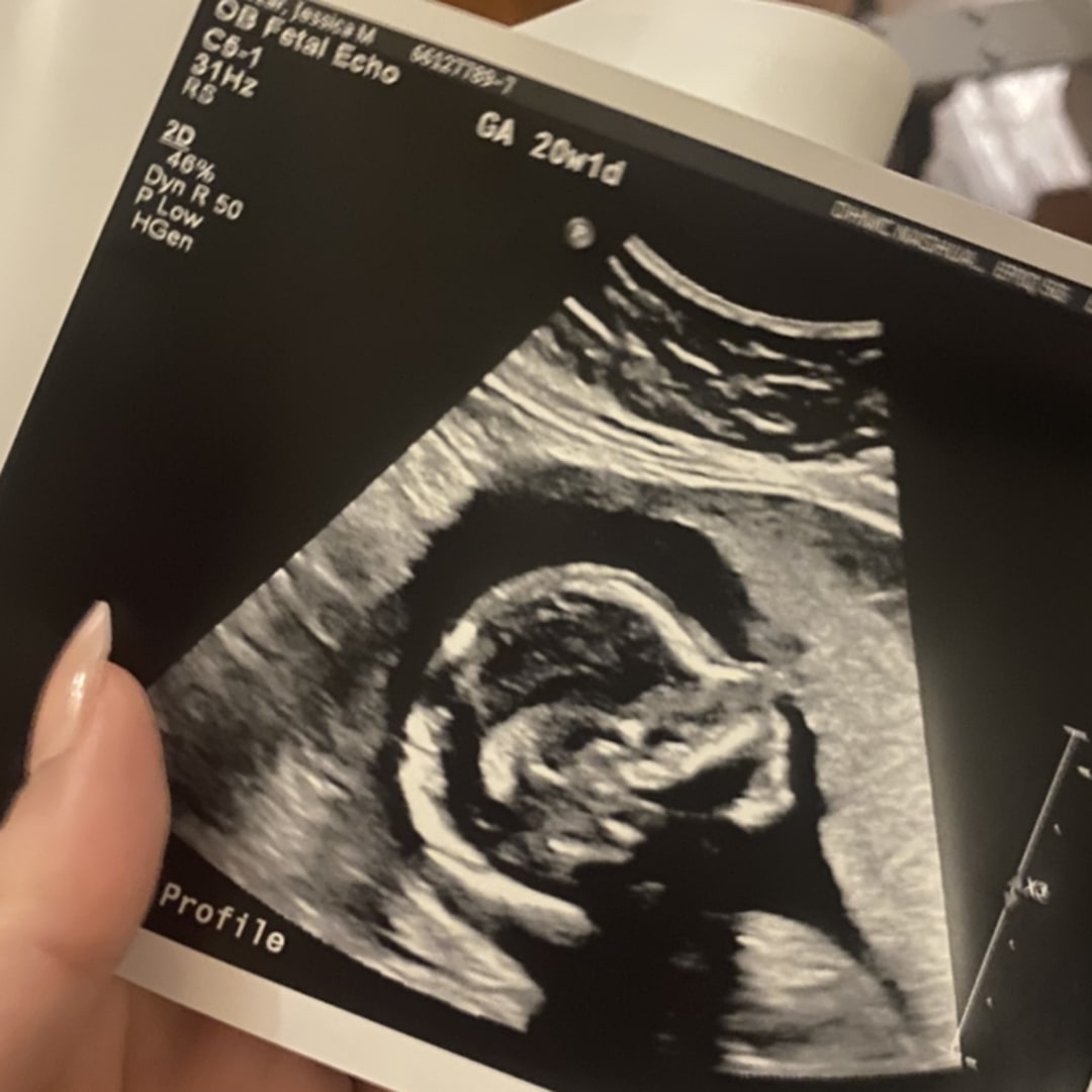 Photo shared by Jessica for their Babylist baby registry.