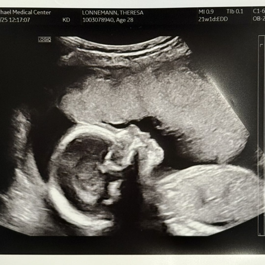 Photo shared by Theresa for their Babylist baby registry.