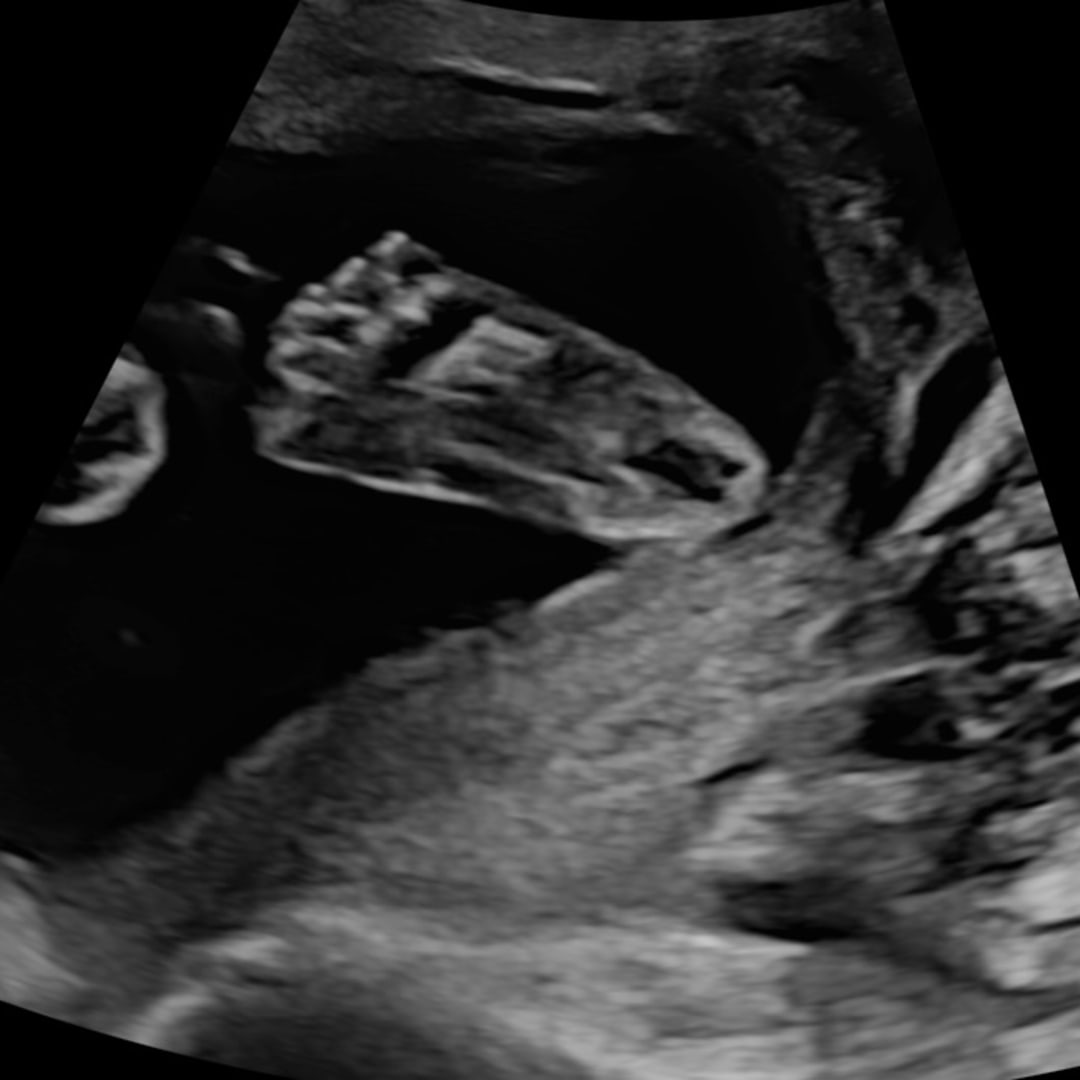 Photo shared by Madeline for their Babylist baby registry.