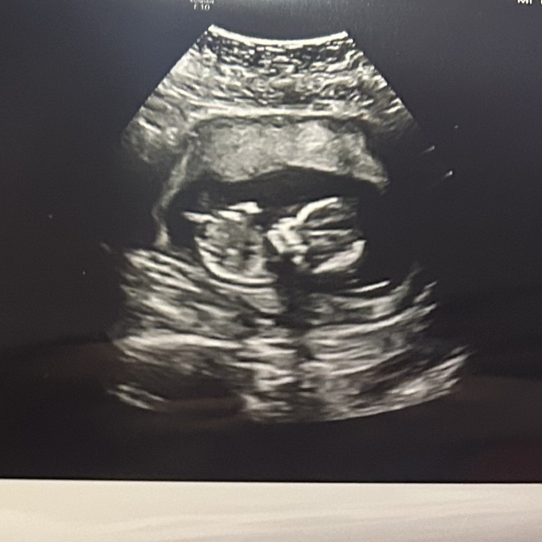 Photo shared by Aracely for their Babylist baby registry.