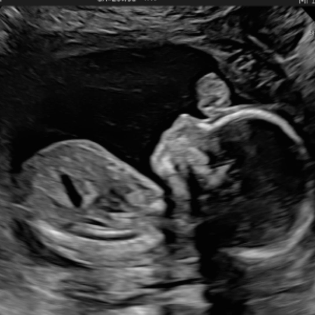 Photo shared by Anabel for their Babylist baby registry.