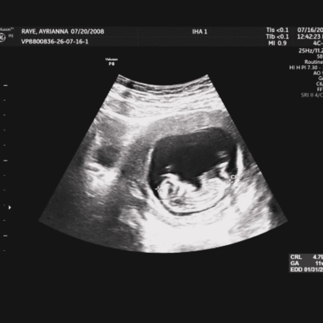 Photo shared by Ayrianna for their Babylist baby registry.
