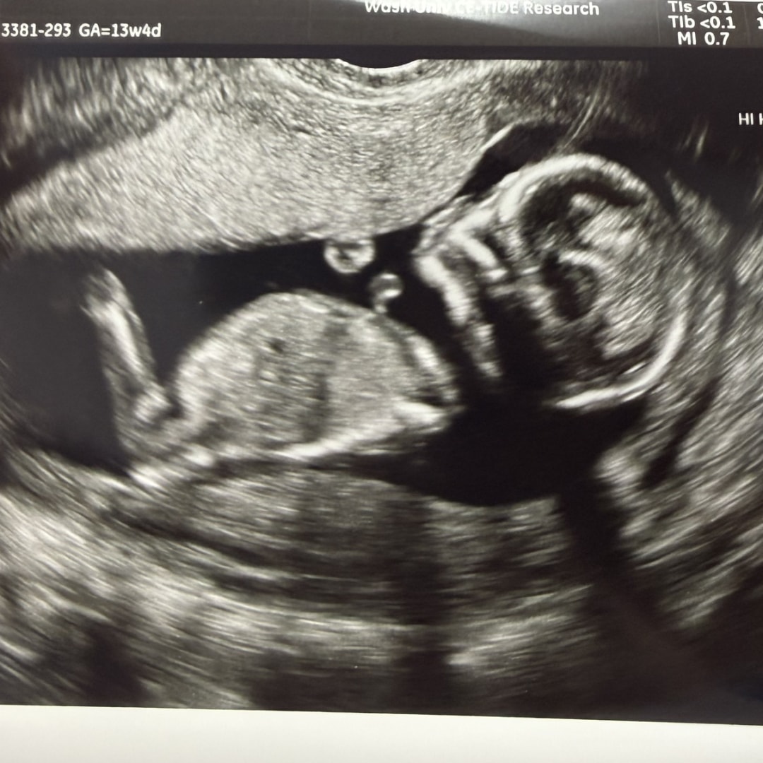 Photo shared by Ashlyn for their Babylist baby registry.