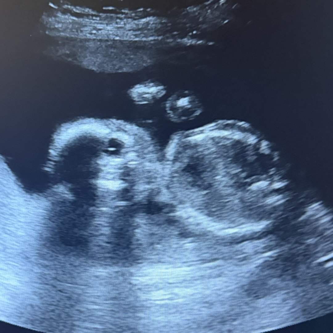 Photo shared by Grace for their Babylist baby registry.