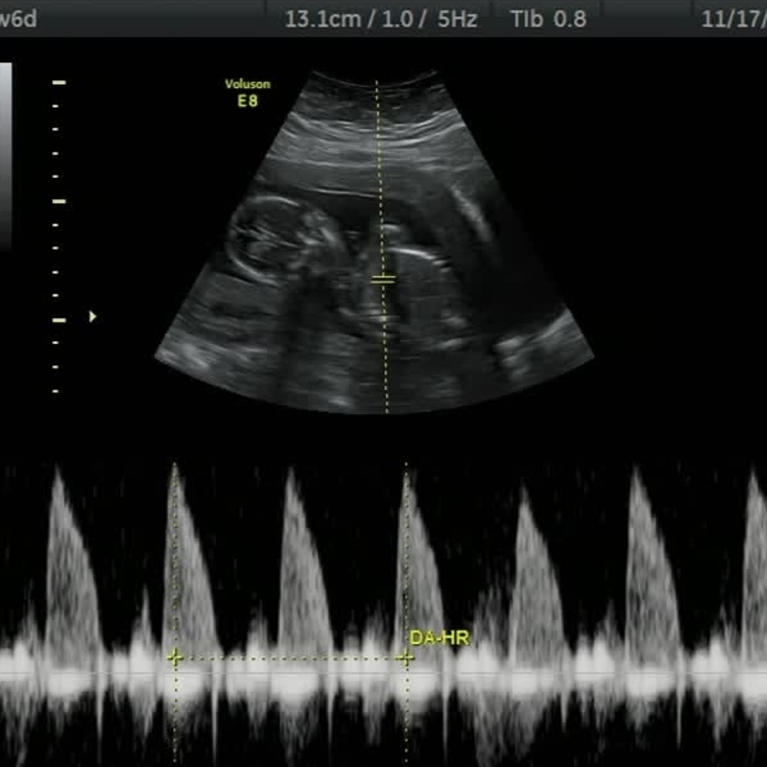 Photo shared by Grace for their Babylist baby registry.