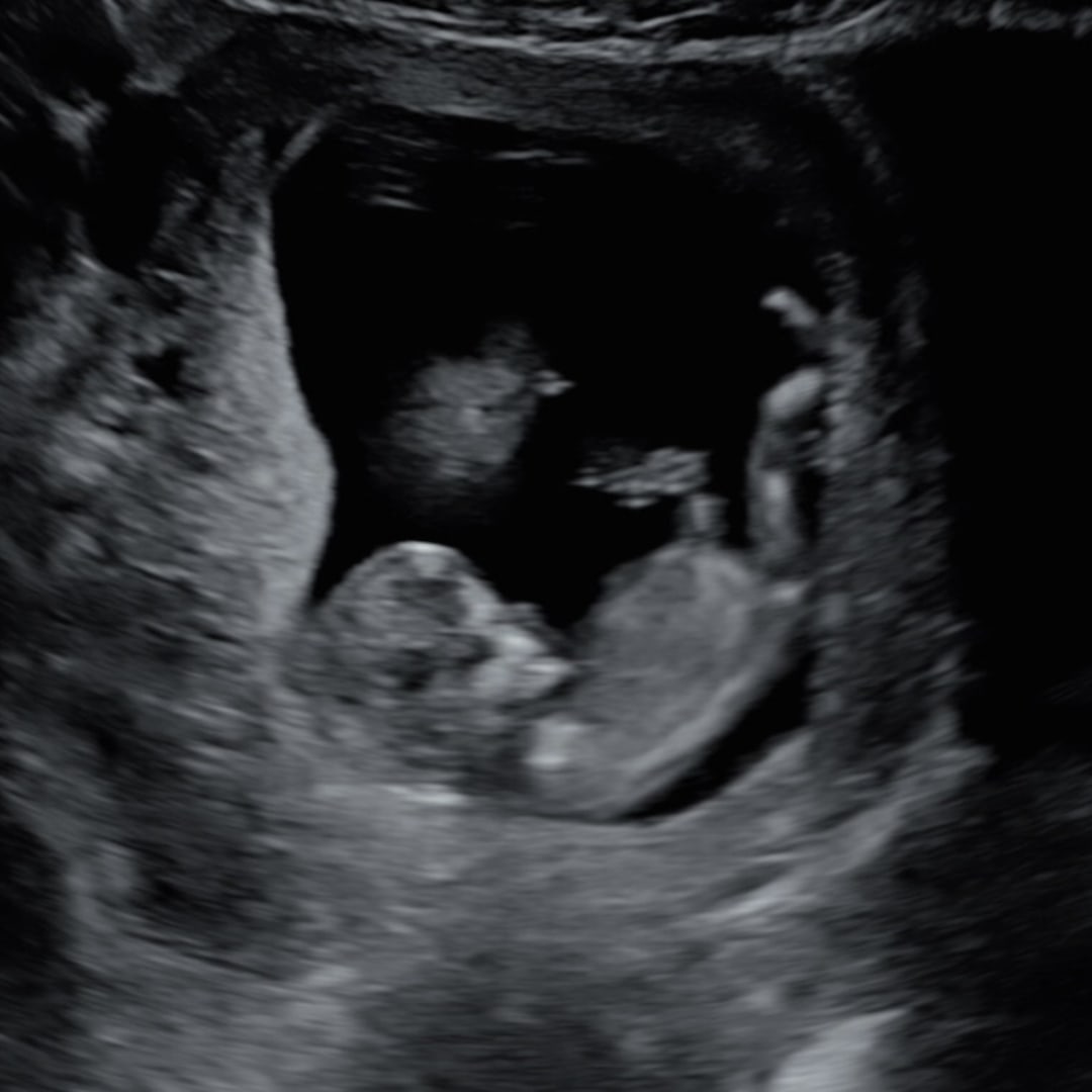 Photo shared by Ashton for their Babylist baby registry.