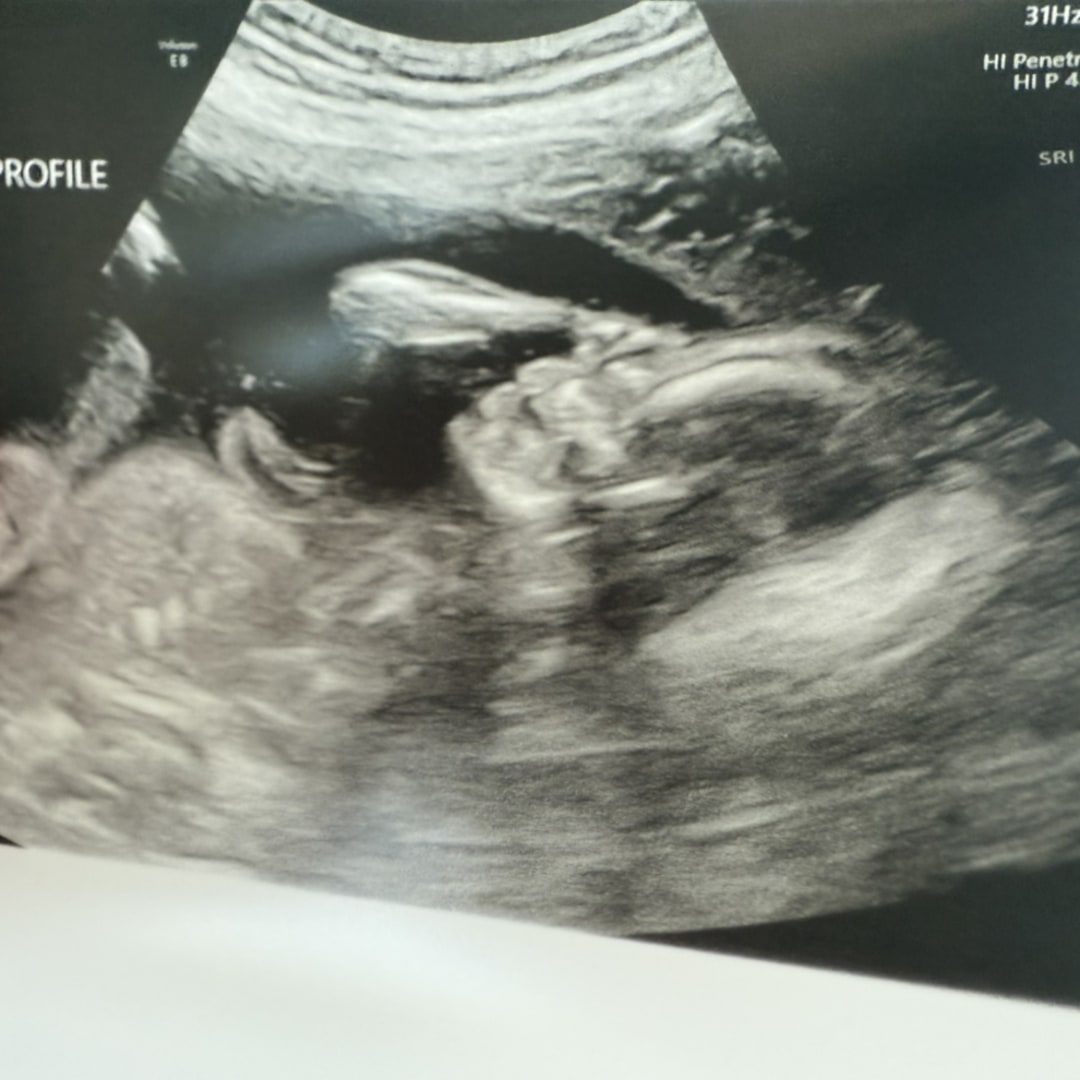 Photo shared by Camille for their Babylist baby registry.
