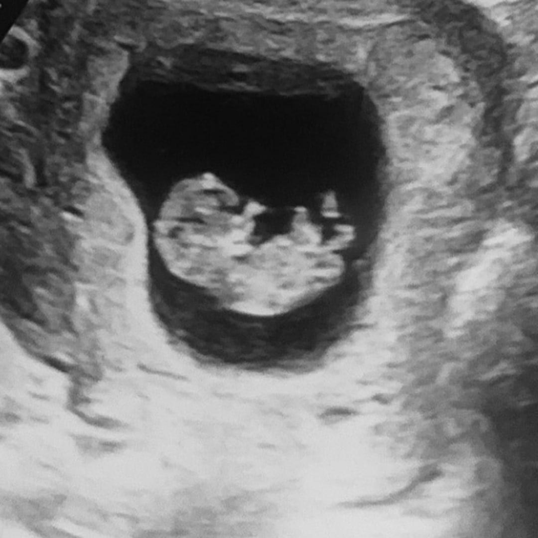 Photo shared by Angelina for their Babylist baby registry.