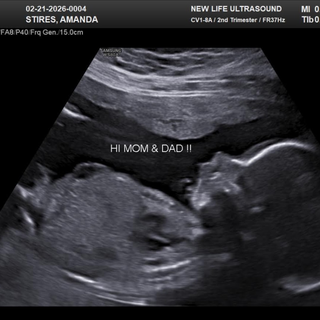 Photo shared by Amanda for their Babylist baby registry.