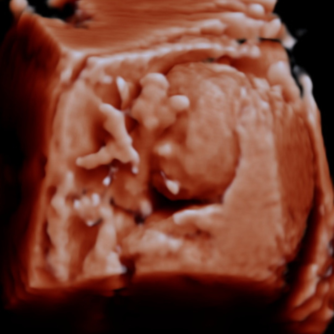 Photo shared by Emily for their Babylist baby registry.