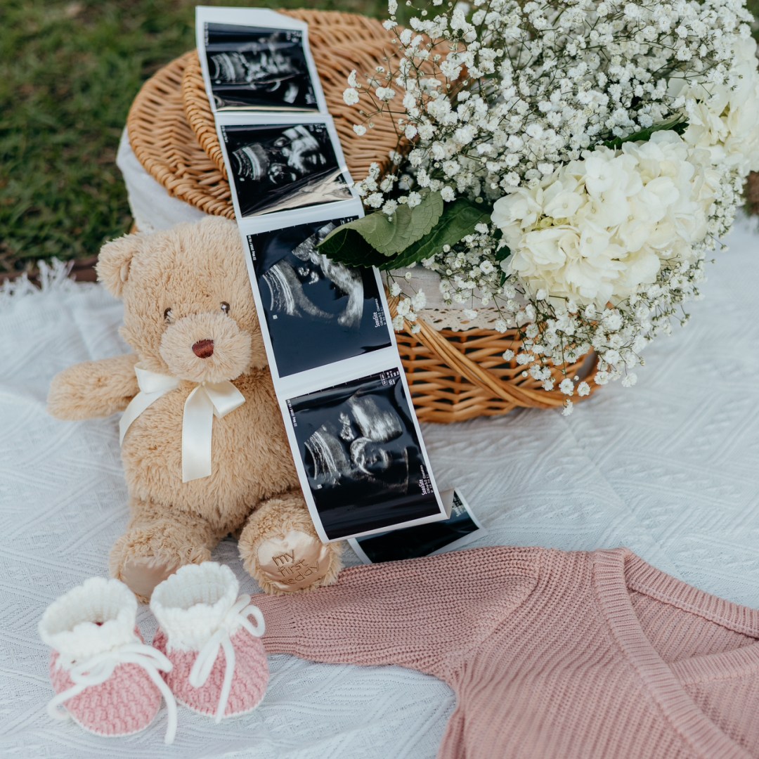 Photo shared by Athena for their Babylist baby registry.