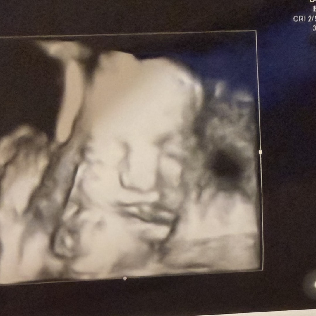 Photo shared by Cynthia for their Babylist baby registry.