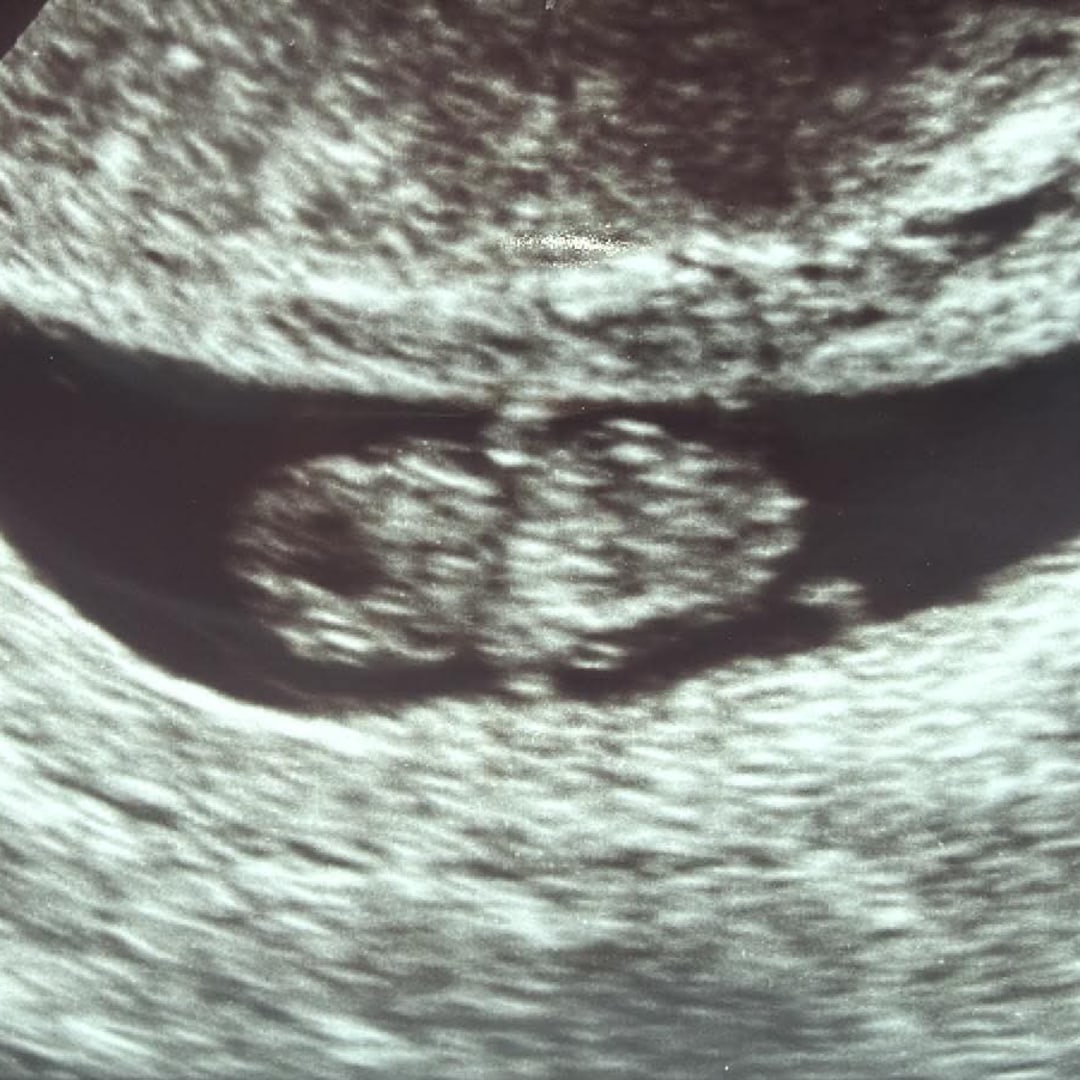 Photo shared by Karle for their Babylist baby registry.