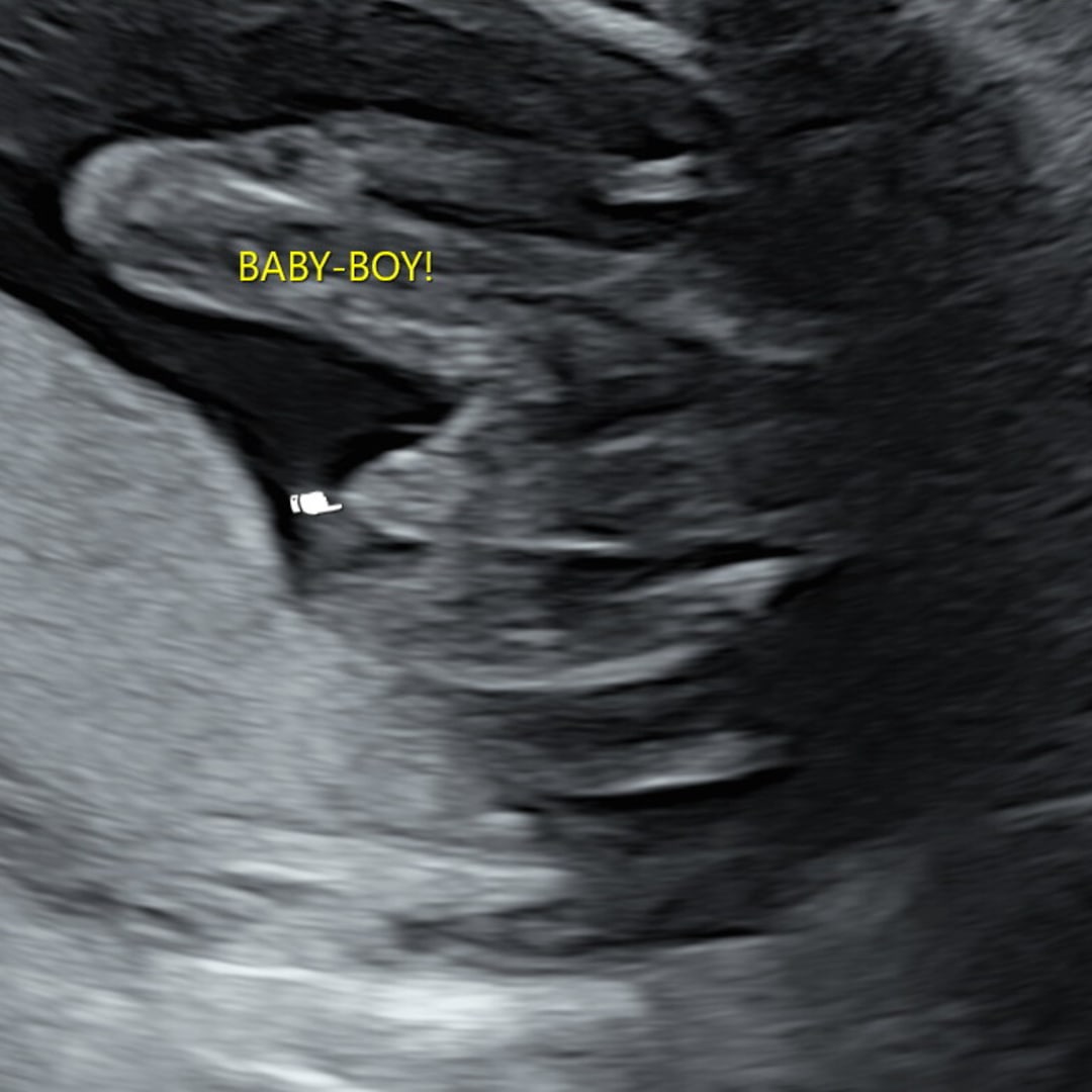 Photo shared by Elizabeth for their Babylist baby registry.
