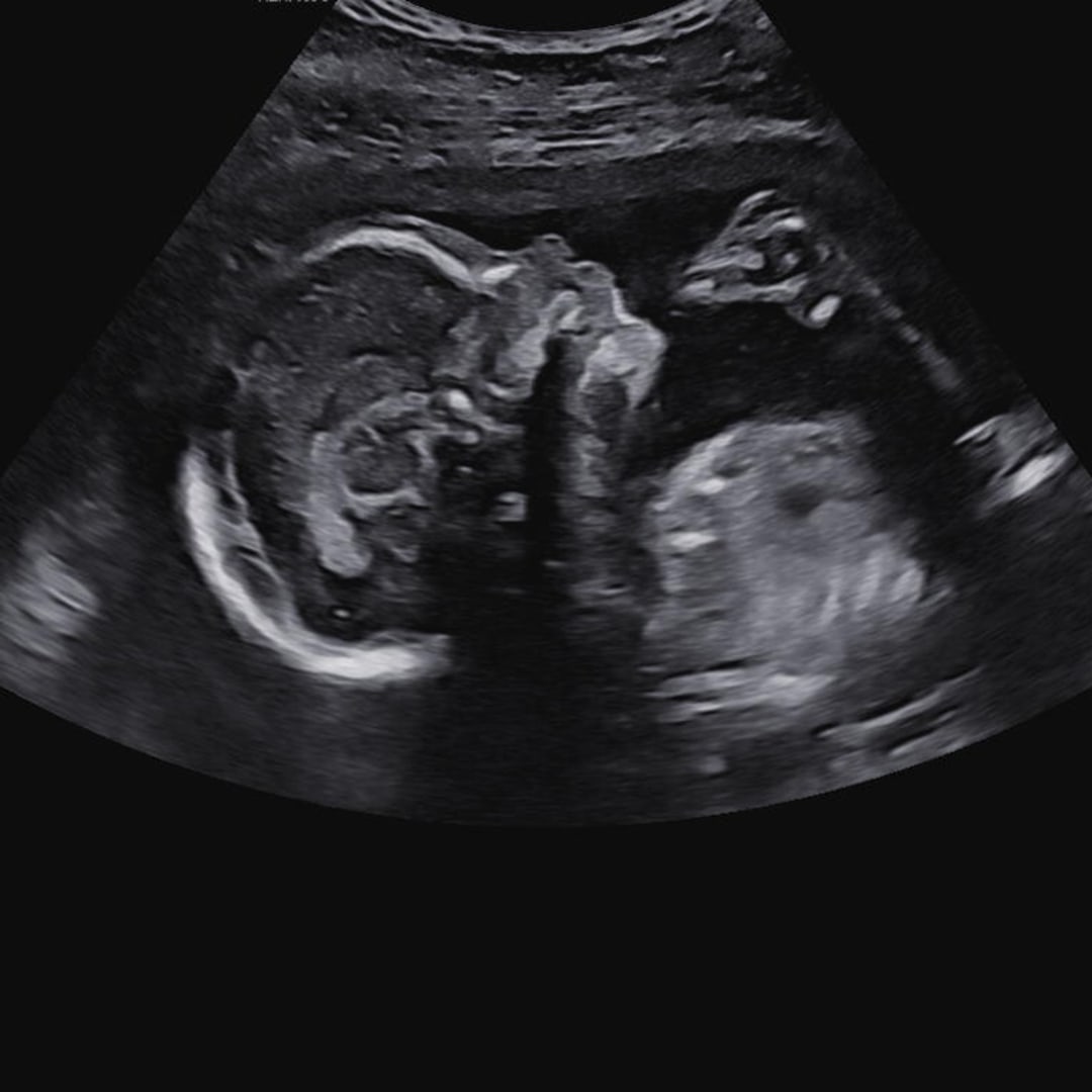 Photo shared by Marri for their Babylist baby registry.