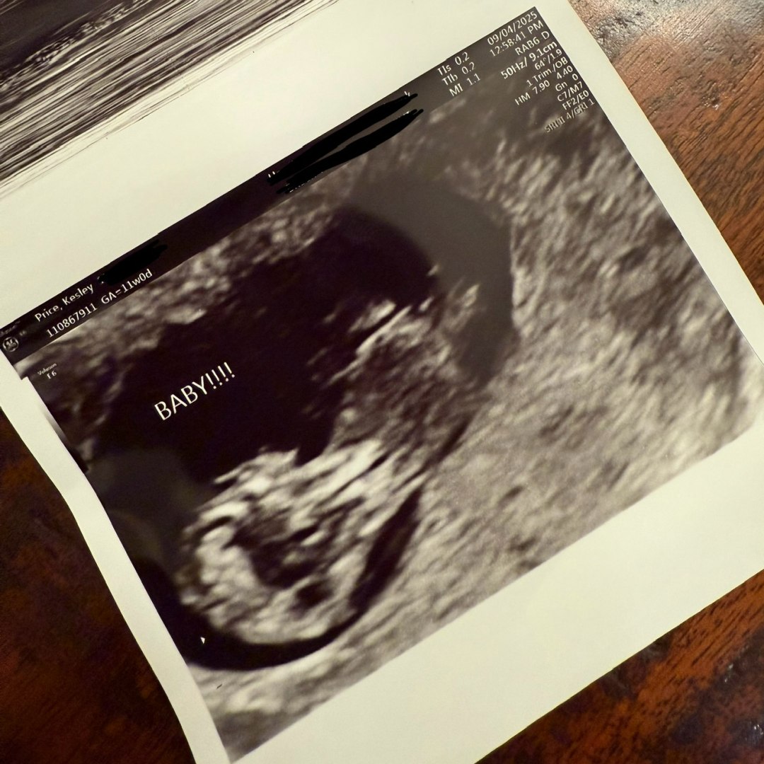 Photo shared by Kesley for their Babylist baby registry.