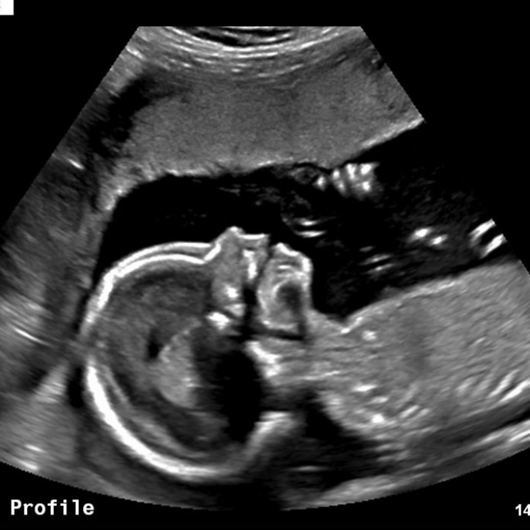 Photo shared by Ellie for their Babylist baby registry.