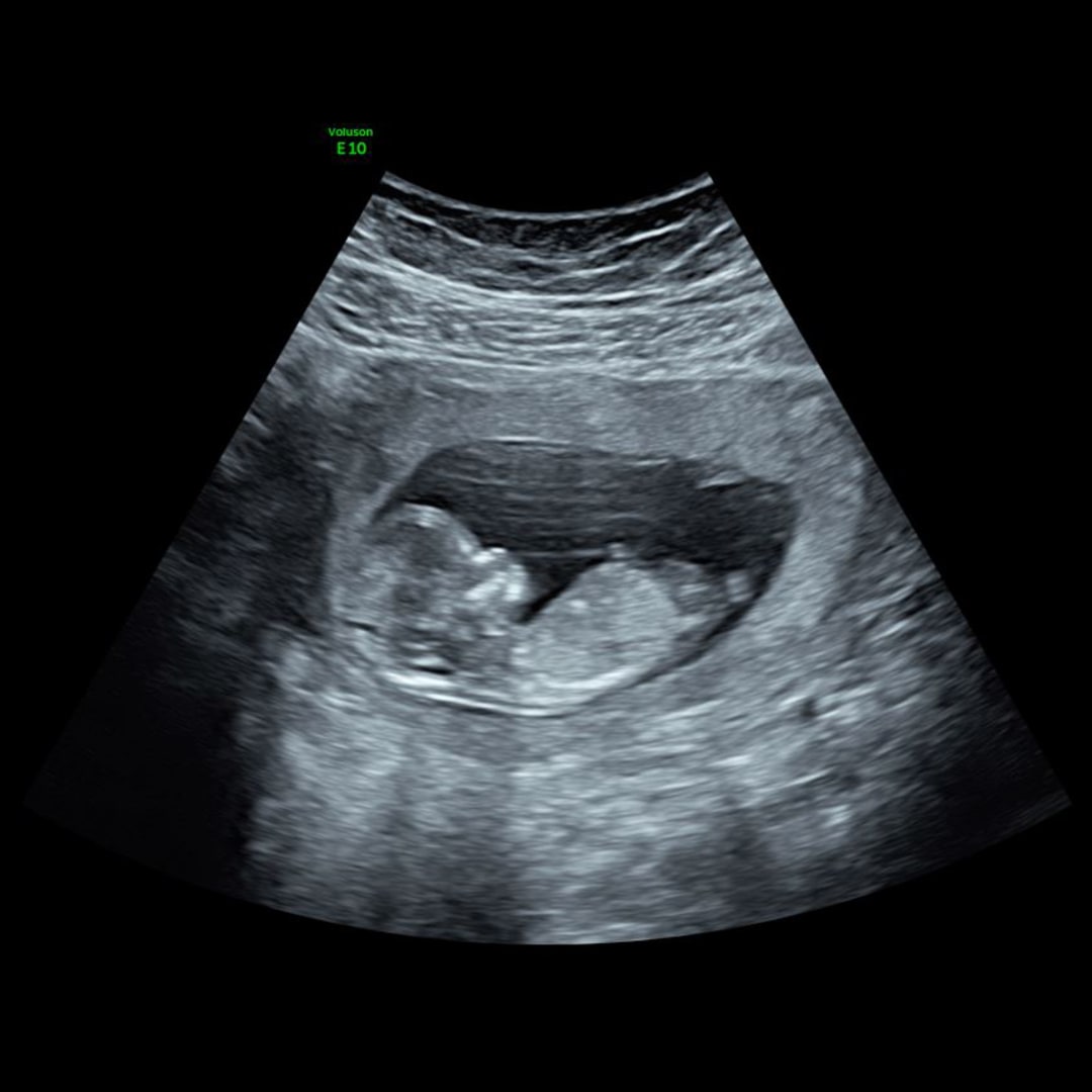 Photo shared by Shelby for their Babylist baby registry.