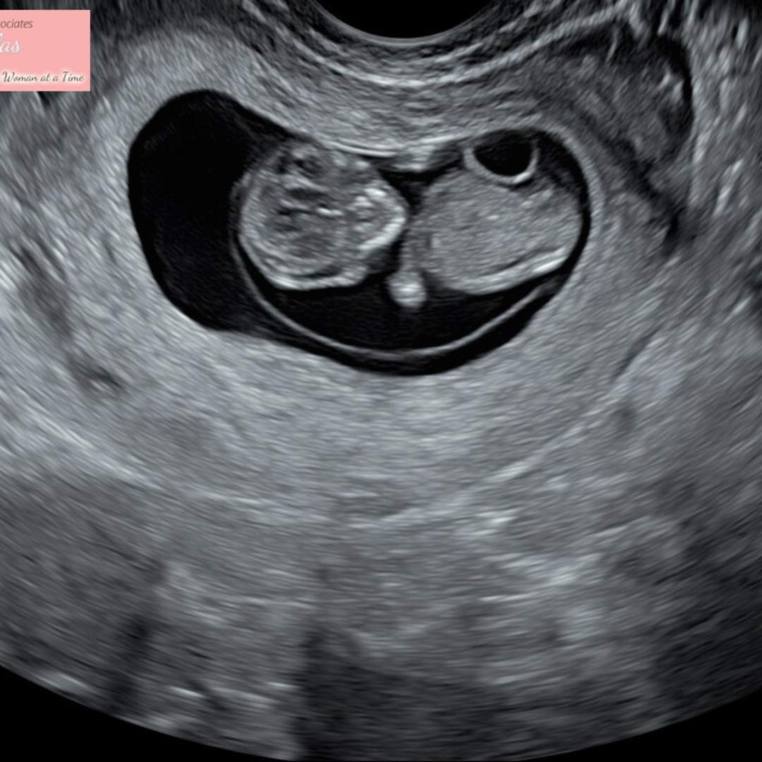 Photo shared by Amy for their Babylist baby registry.