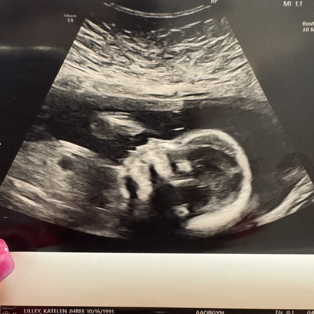 Photo shared by Jhree for their Babylist baby registry.