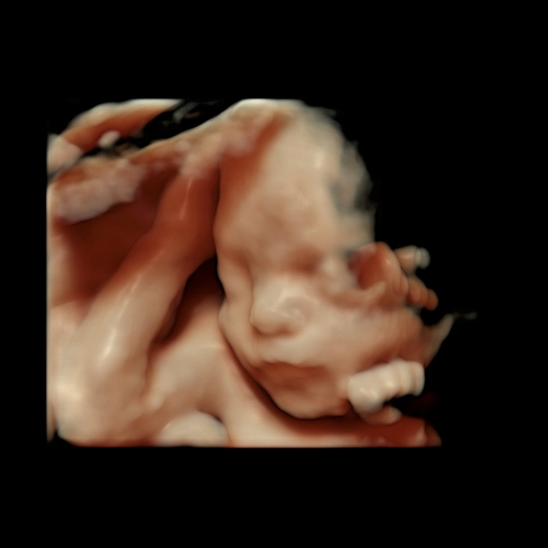 Photo shared by Kenzie for their Babylist baby registry.