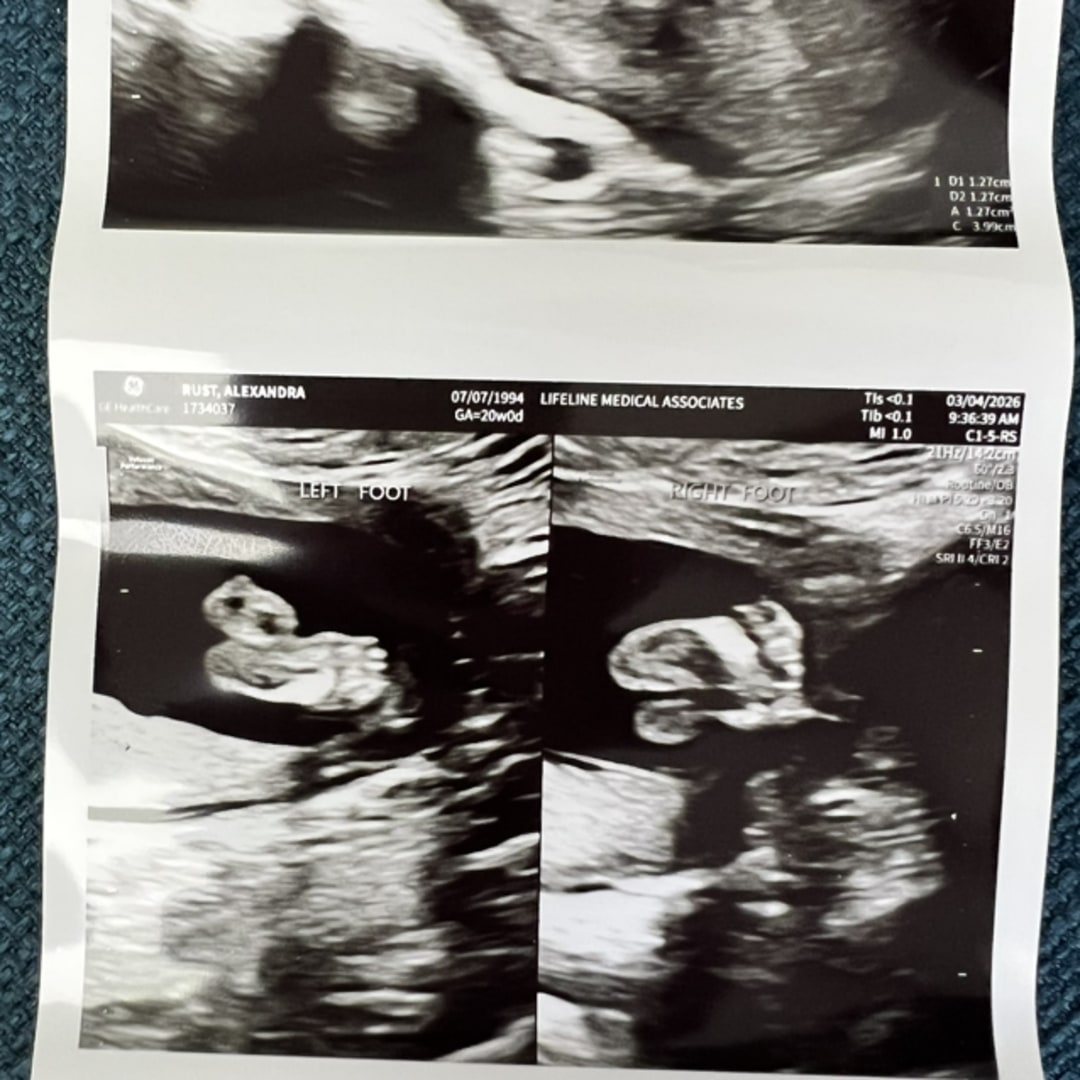 Photo shared by Alexandra for their Babylist baby registry.