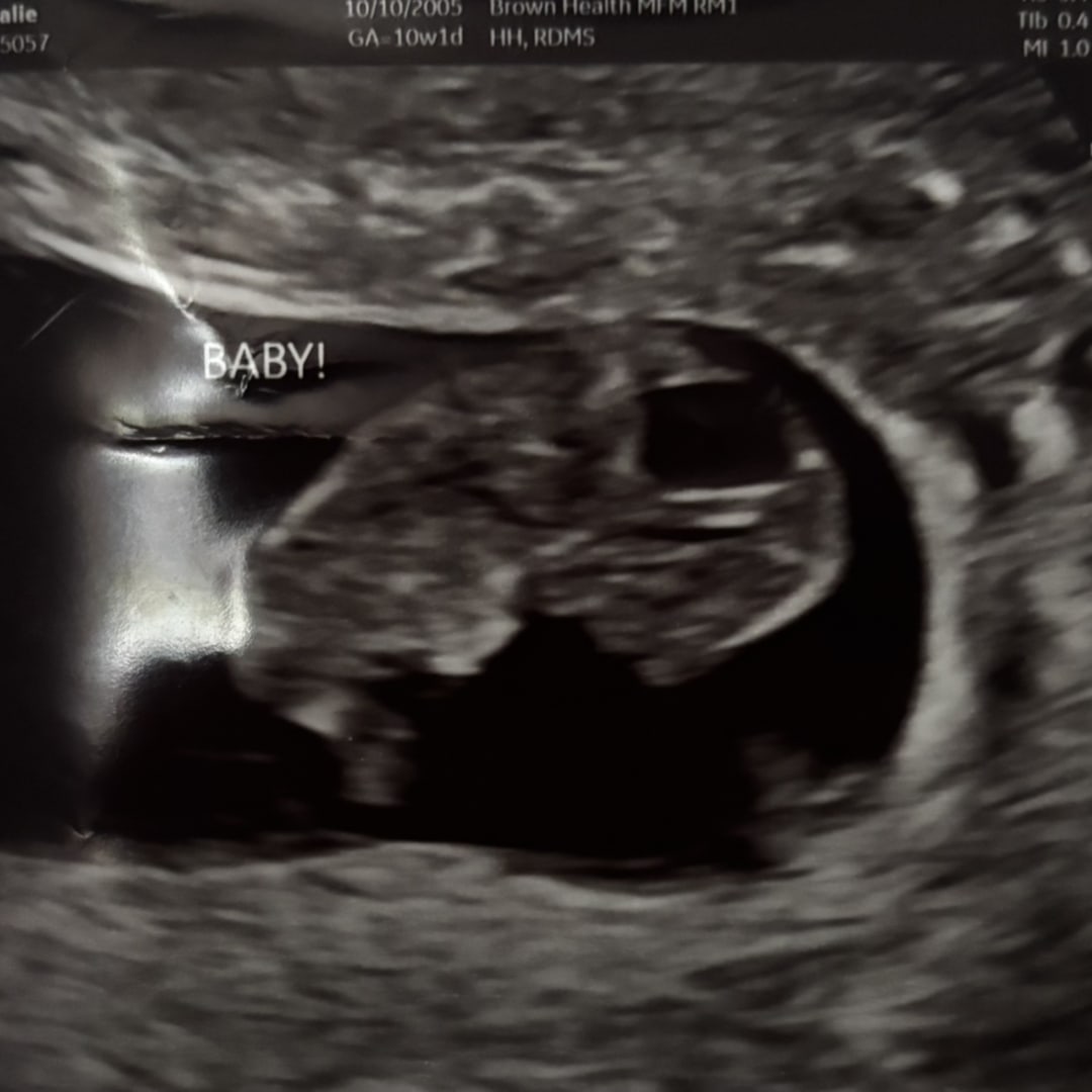 Photo shared by Kealie for their Babylist baby registry.