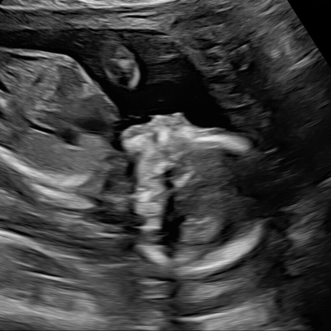 Photo shared by Allison for their Babylist baby registry.